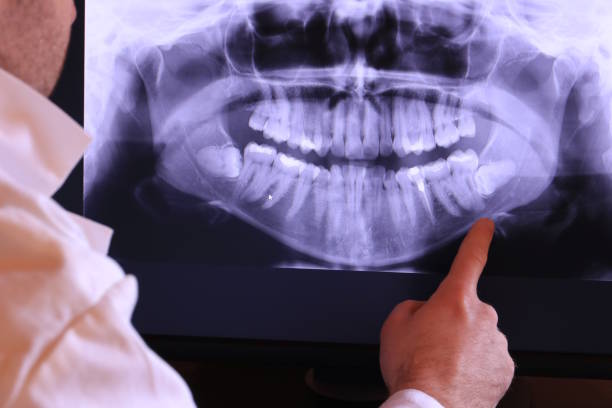 Best Emergency Dental Care for Broken or Chipped Teeth in St John, KS