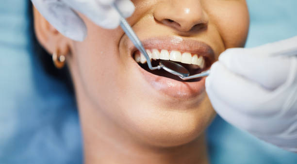 Best Emergency Dental Care for Broken or Chipped Teeth in St John, KS