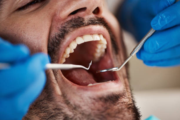 Best Emergency Orthodontic Services in St John, KS